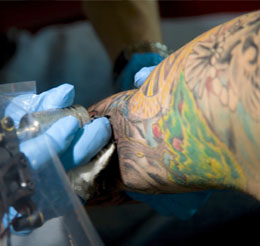 Sanitas Eliminación de tatuajes