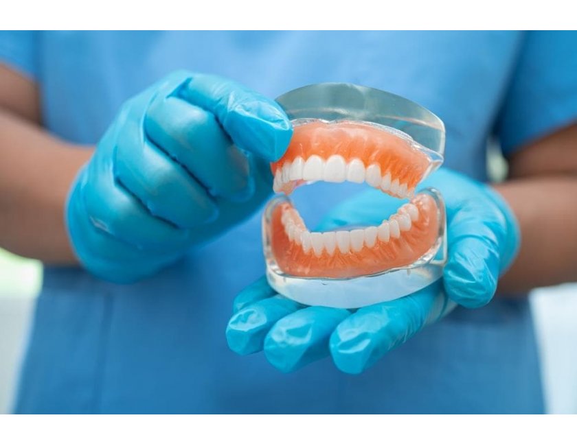 Qué es una prótesis dental y cómo ayuda a mejorar nuestra salud bucodental