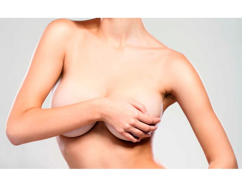 Aumento de pecho o mamoplastia